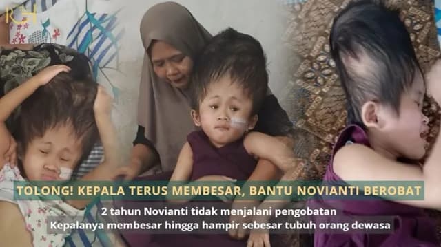 Kepala Terus Membesar - Bantu Novianti Berobat