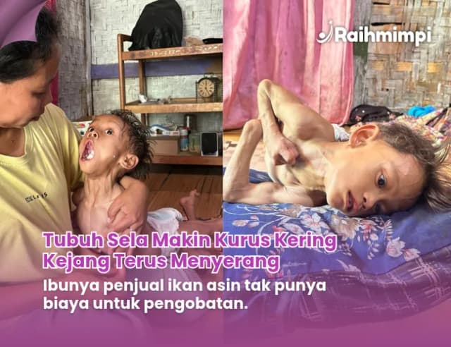Jualan ikan Asin tak laku, kondisi Sela Tinggal Tulang Berbalut kulit