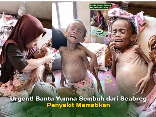 Bantu Yumna Sembuh dari Seabreg Penyakit Mematikan