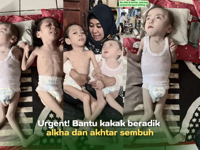 Bantu kakak beradik alkha dan akhtar sembuh