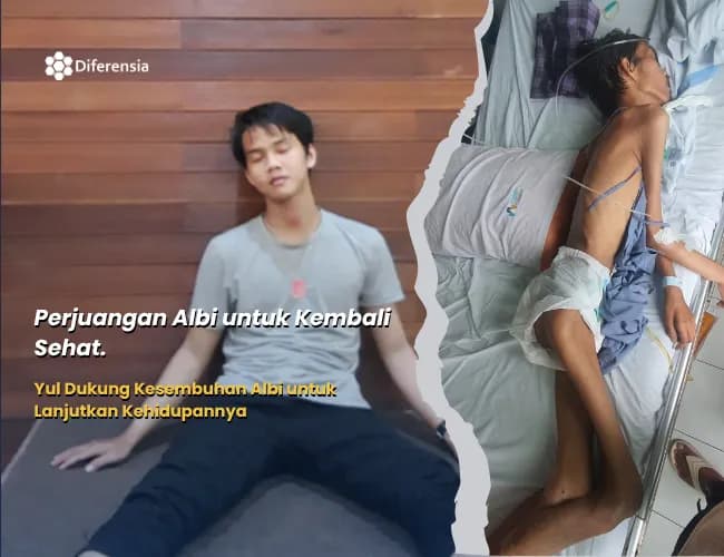 Foto campaign Dukung Albi Pemuda yang Kehilangan Masa Depan Setelah Kecelakaan Kerja